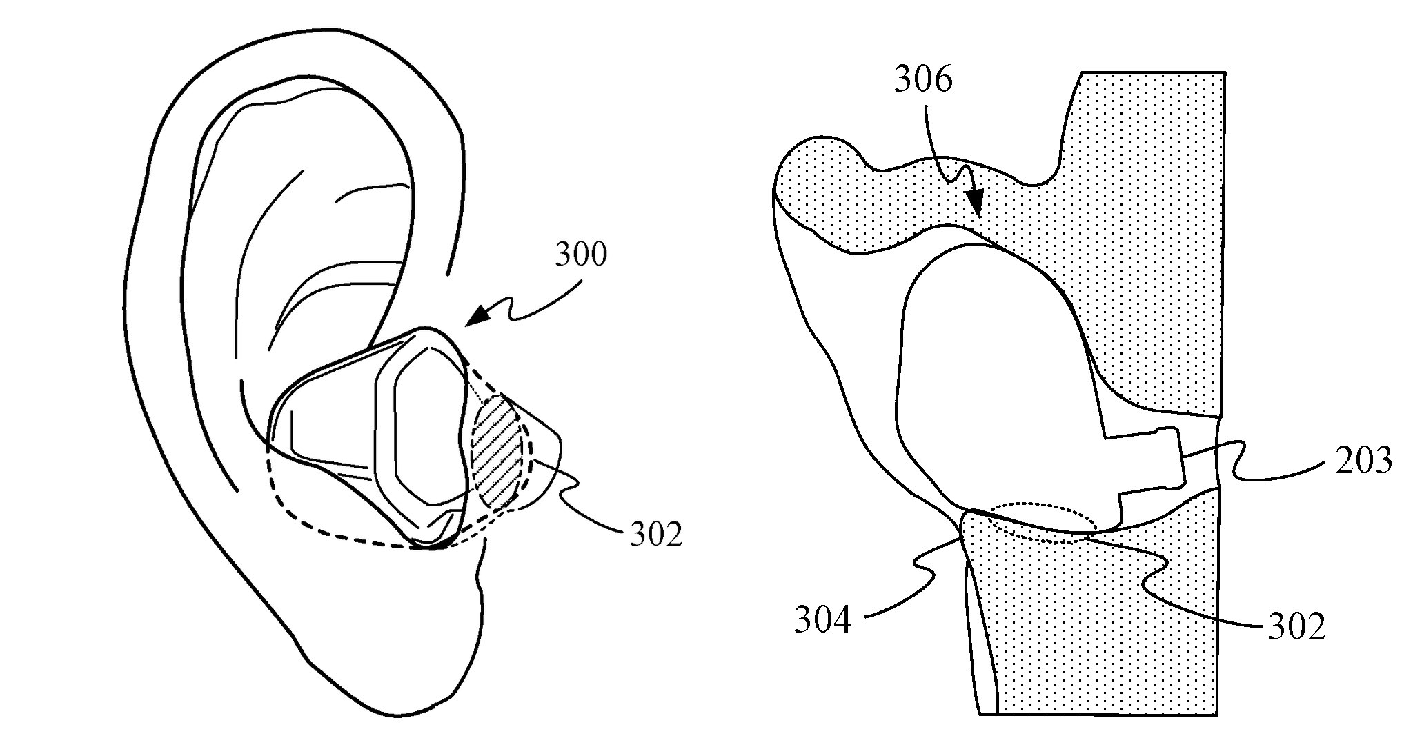 Apples Patentzeichnung für AirPods mit Gesundheitsüberwachung
