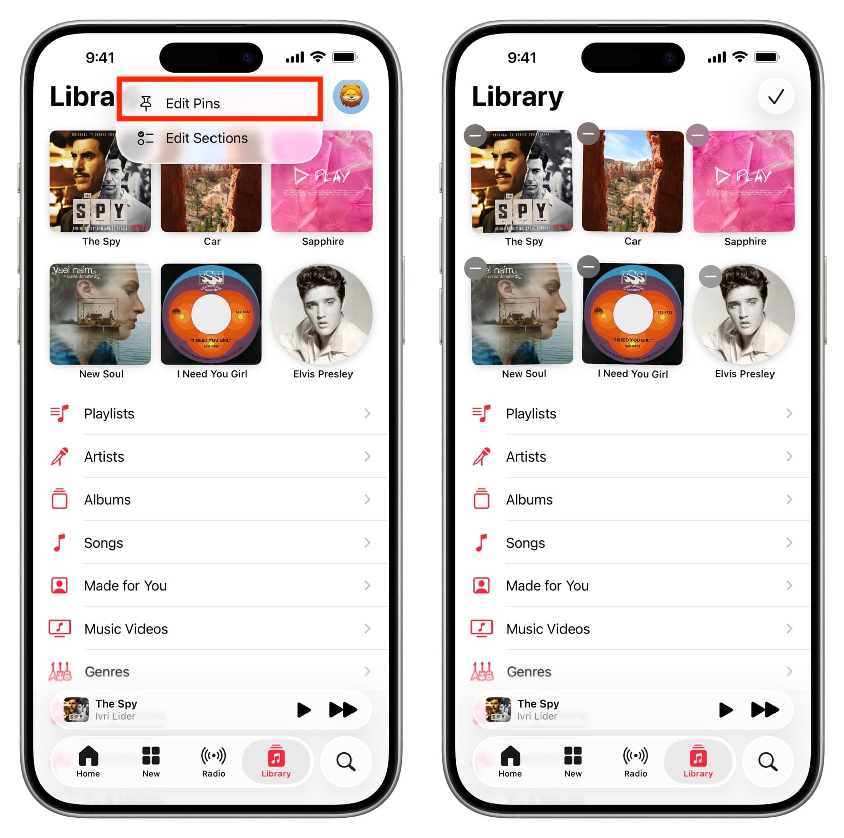 Edit Pins in iOS Music app