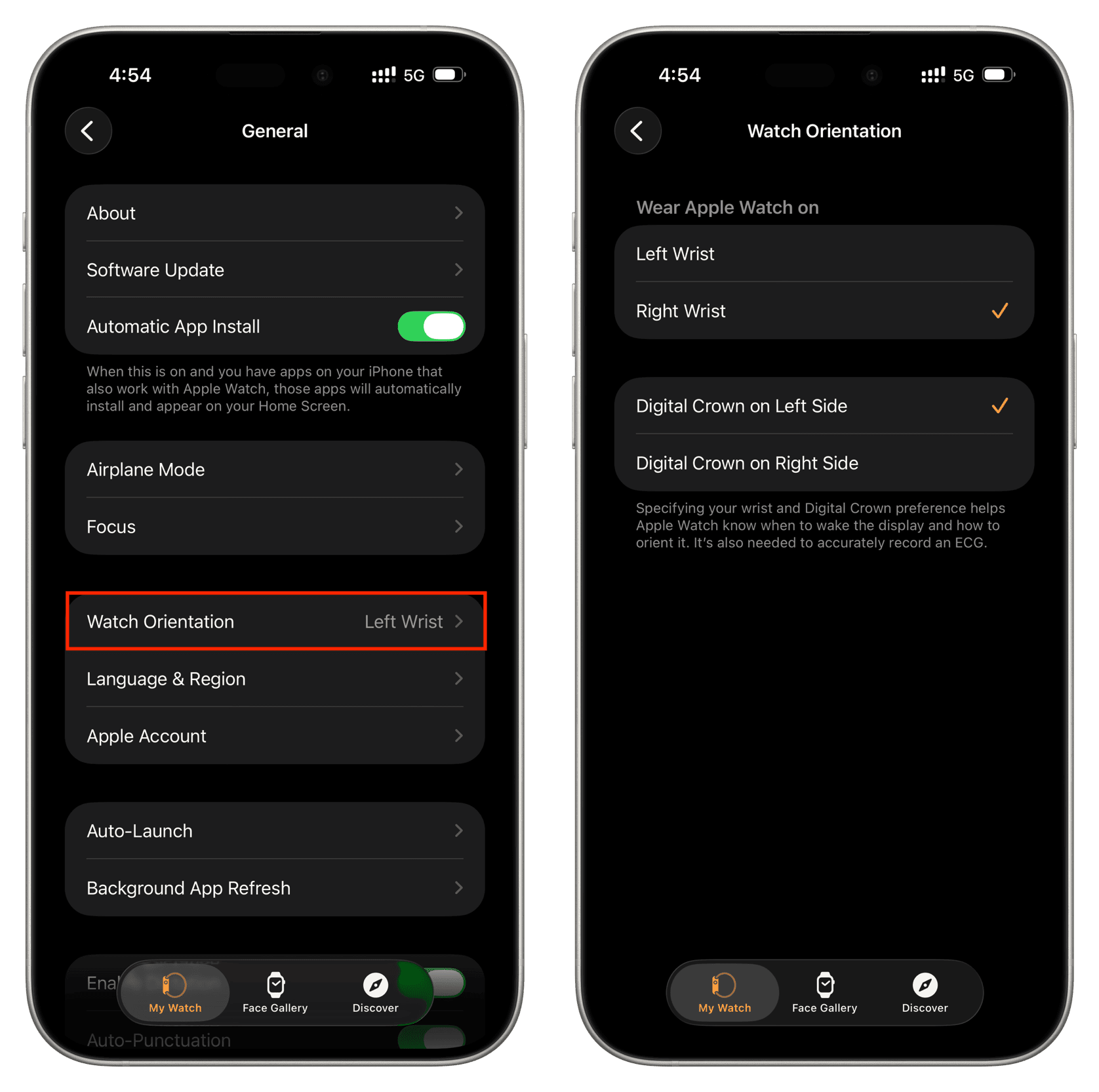 Die Orientierung in Watch App -Einstellungen auf dem iPhone ansehen